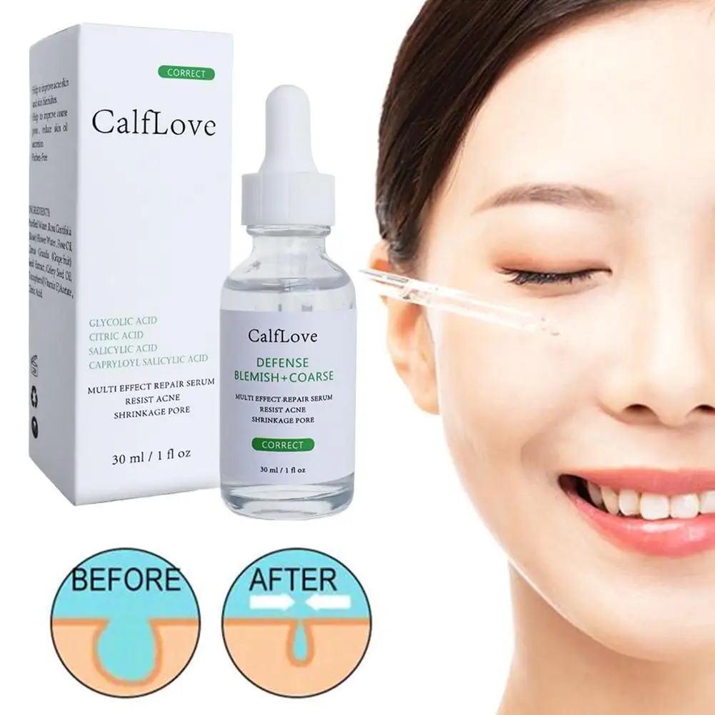 

30ml Salicylic Acid Shrink Pores Essence Face Skin Care Anti-blackhead Whitening Anti-aging Tool Care Skin Essence Moisturi X1T8
