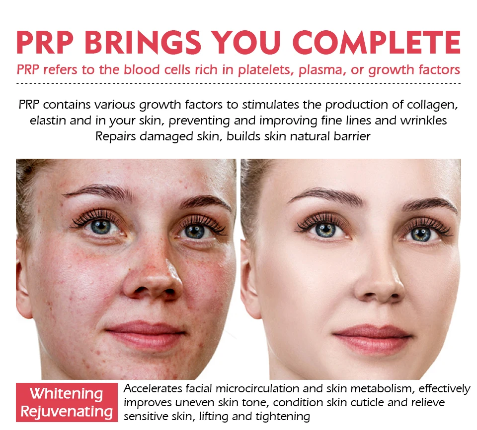 血清蛋白无水面膜_04