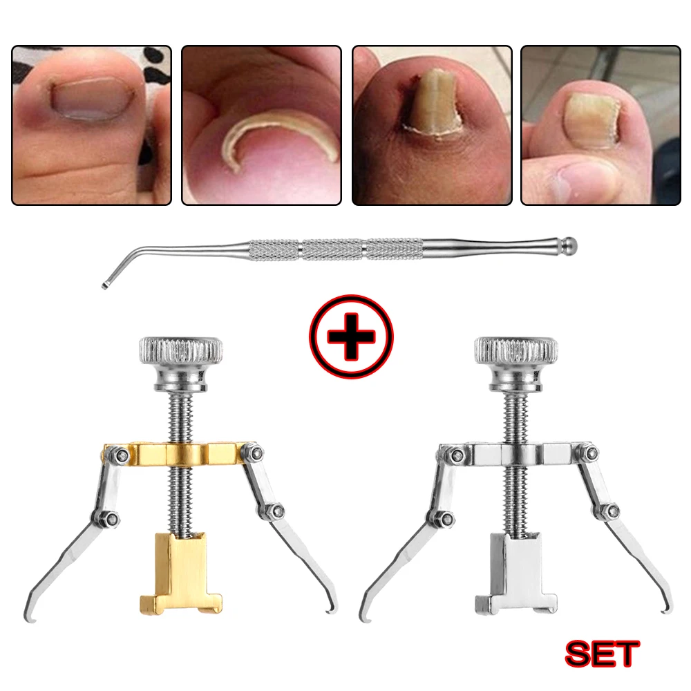 1PC Gold/Silver Stainless Steel Ingrown Toenail Correction Toes Nail Cuticle Pusher Anti Paronychia Foot Care Pedicure Tools Set | Красота и