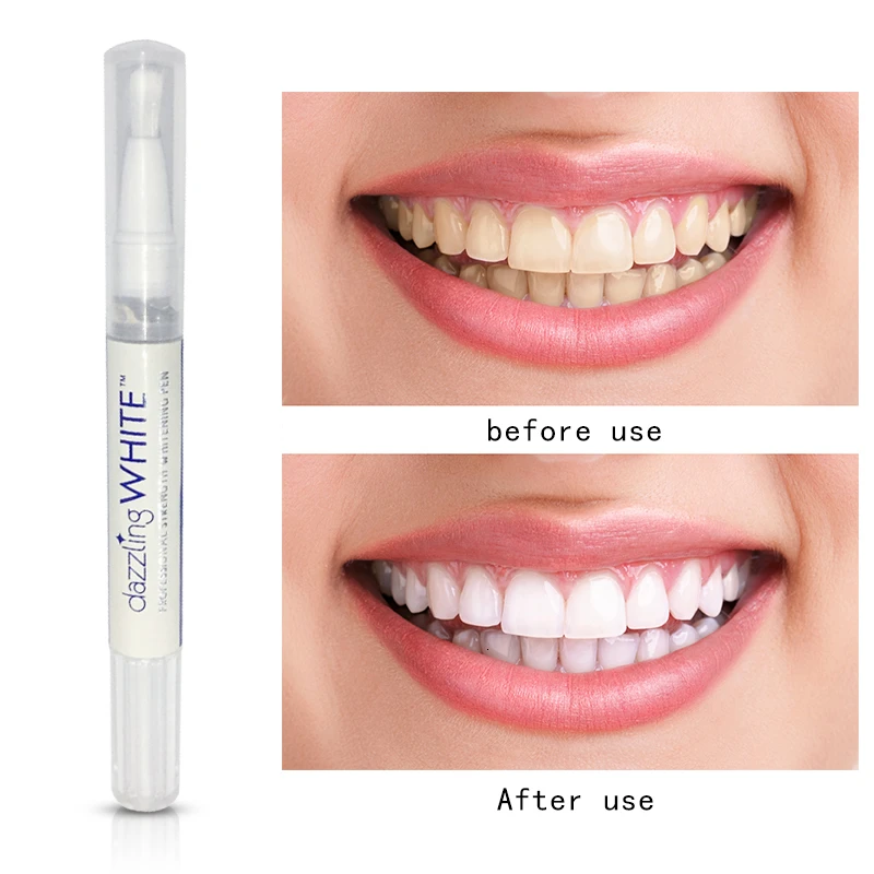 Rotary Beauty Cleaner Teeth Whitening Bright White Teeth Whitening Toothbrush Essence Pen