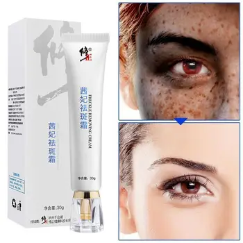 

Effective Whitening Freckle Cream 30g Remove Melasma Acne Spots Moisturizing Skin Dark Spot Whitening Pigment Care Cream Me J2V8