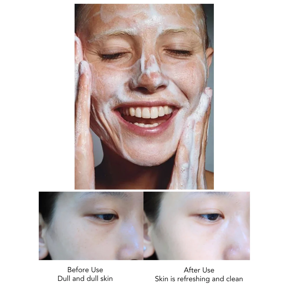 AILKE Rose Facial Cleanser Women Whitening Moisturizing Cleaning Cleaner Hydrating Anti-Dark Spots, Oil Control Face Care Scrub 5