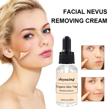 

20ml Liquid Solution Painless Portable Professional Dark Spot Freckle Foot Corn Body Care Mole Home Skin Tag Remover Serum Wart