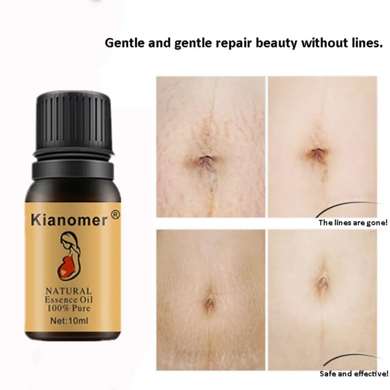 Stretch Marks Repair Essential Oil Nourishing Skin Lightening Pigment Stretch Marks Removal Oil