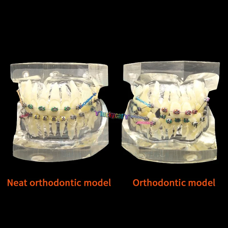 1 шт. зубная, Ортодонтическая модель с красочными кронштейнами модели неправильного прикуса обучающая модель Стоматологический материал инструменты для стоматолога