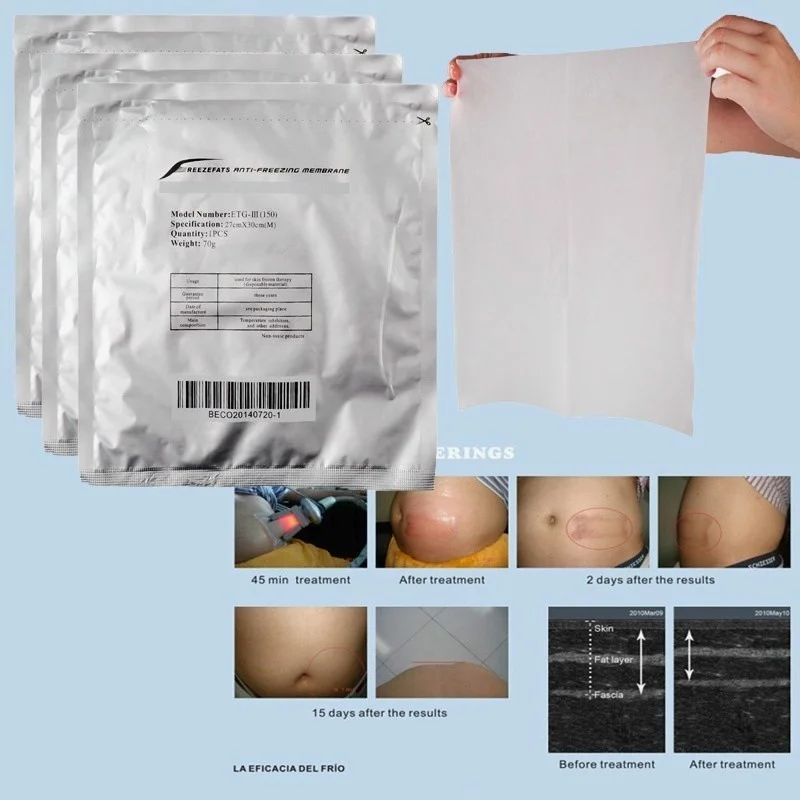 Package 28X28Cm Size Antifreeze Membrane-Freezing Membranes Cryo Cool Gel Pad Anti Freeze Cryotherapy Membrane | Красота и здоровье