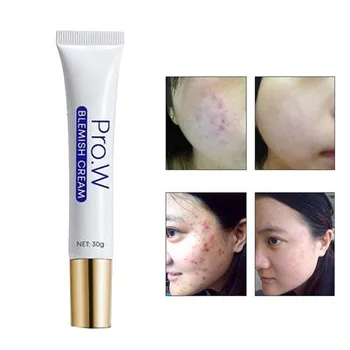 

Pro.W Blemish Cream Freckles Acne Pimple Scar Dark Spots Removal Skin Whitening Brightening Remove Spots Firming Dark Cream 30g