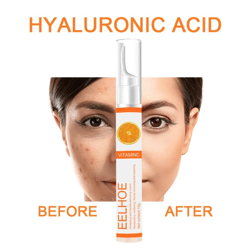 blemish whitening cream