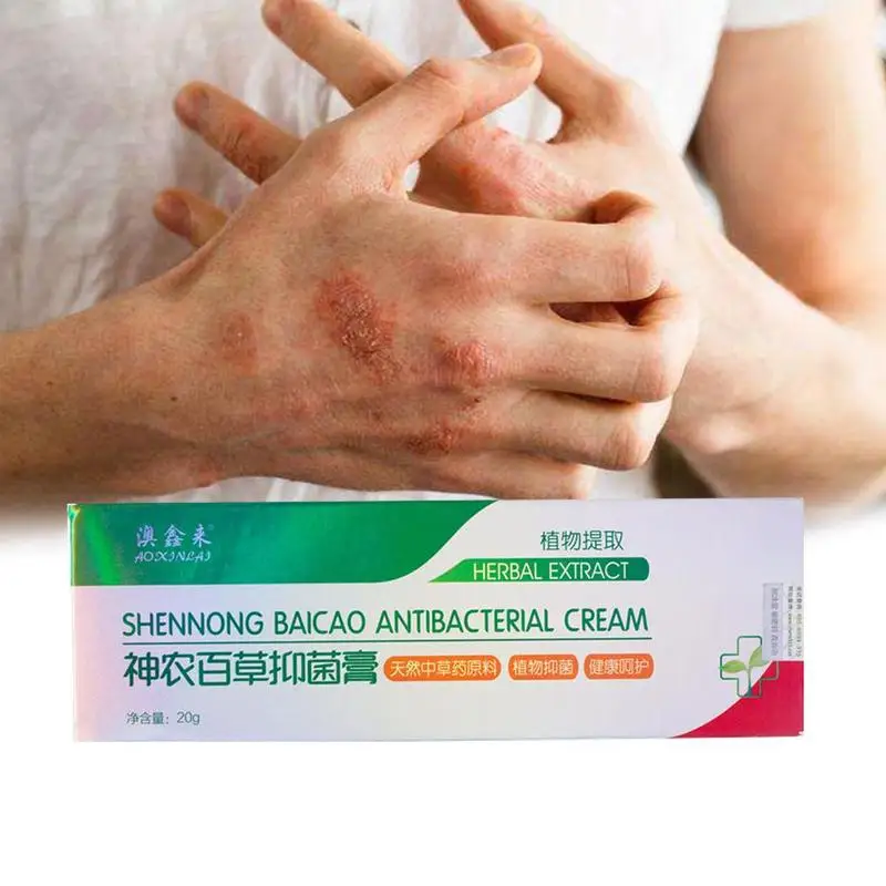 Натуральный присущая средствам китайской медицины травяной Антибактериальный крем псориаз экзема мазь лечение кожи актуальные противозудный крем мазь