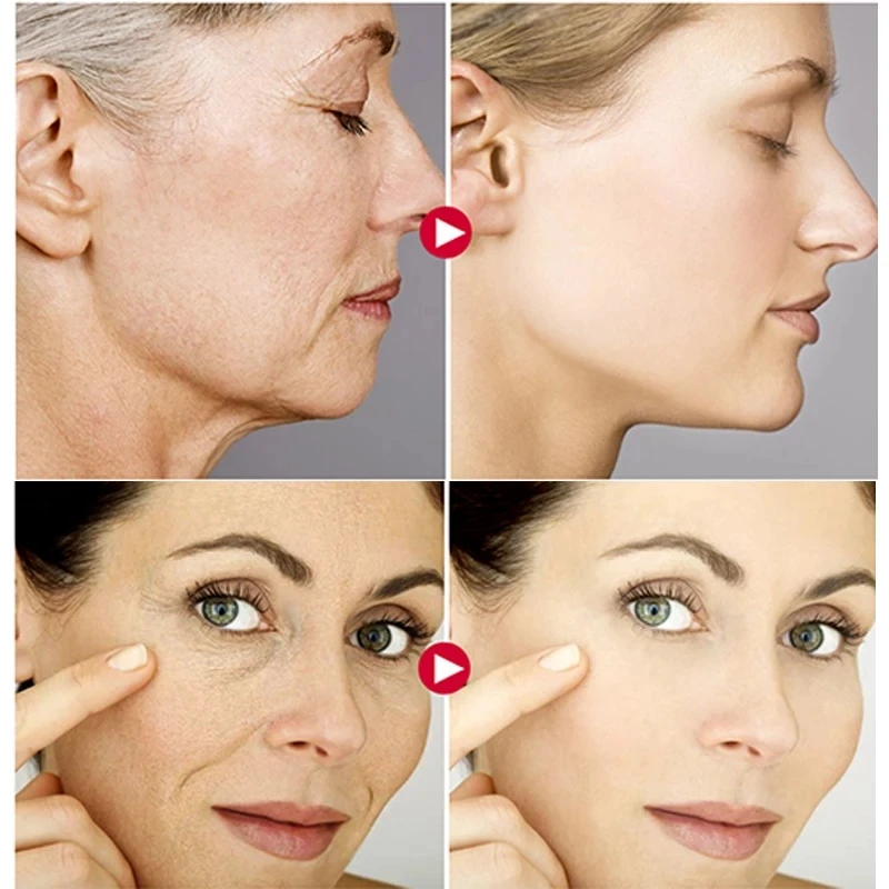 AuQuest 5 Seconds Wrinkle Remover Instant Firmly Anti Aging Moisturizing Remove Fineline Face Cream Beauty Skin Care 20G-3