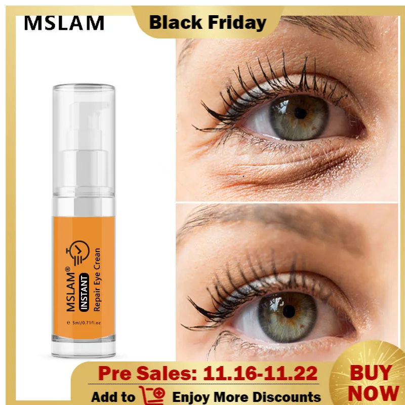 

Eye Cream Nicotinamide Anti-Wrinkle Anti-Age Serum Remove Dark Circle Puffiness Moisturizes Nourishes Tightens Eye Skin Care