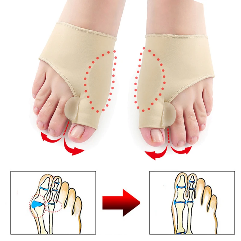 1 пара большой костной вальгусной деформации, корректор ортопедический для ног, корректор костного большого пальца, коррекционный носок для педикюра, выпрямитель для ухода за ногами