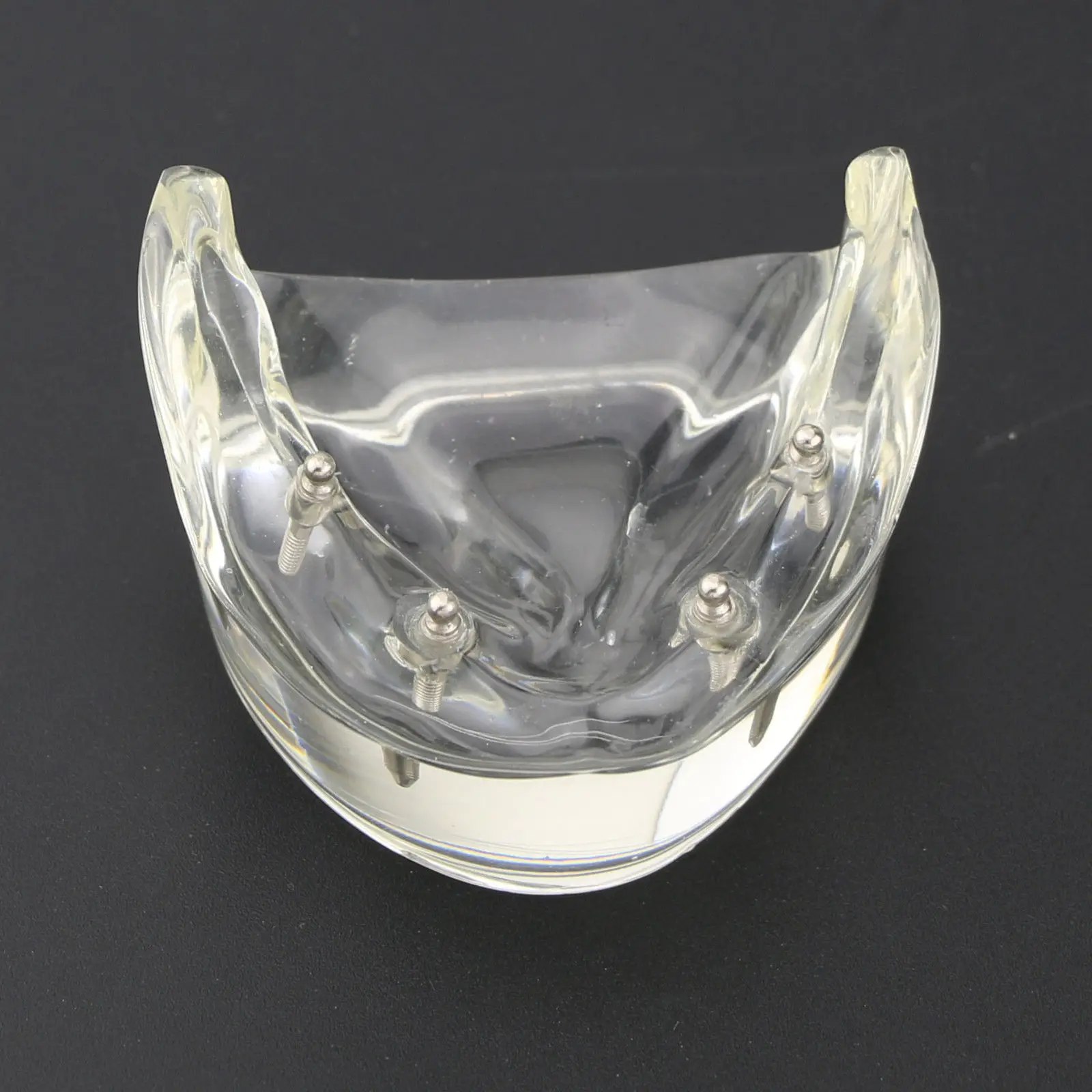 Beste 1Pc Dental Tanden Studie Model Overdenture Inferior 4 Implant Demo Model 6002 02