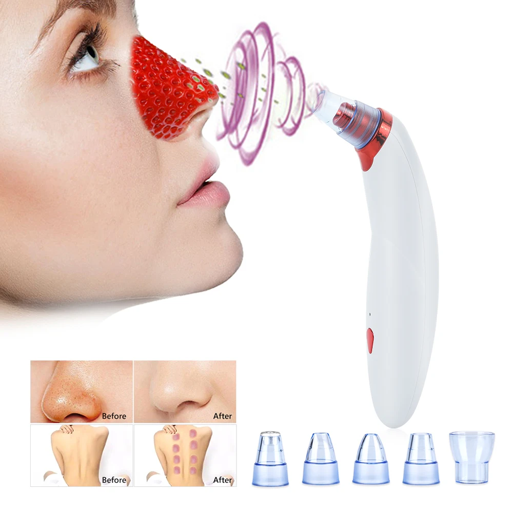 

Blackhead Remover Face Deep Nose Cleaner T Zone Pore Acne Pimple Removal Vacuum Suction Facial Diamond Beauty Clean Skin Tool