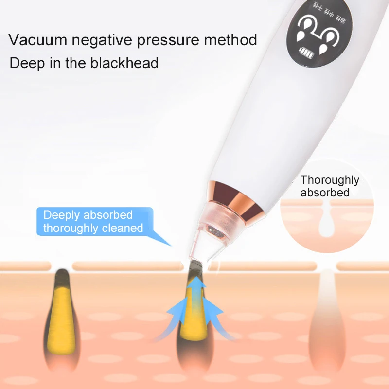 Для прыщейудаление черных точек акне прыщи для лица Blackhead Электрический поры Вакуумный Очиститель черных точек полоски для удаления угрей вакуум уход за кожей лица акне пор чистка лица инструмент для ухода за кожей