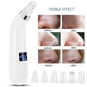 

Electric Blackhead Absorbing Artifact Blackhead Importing Instrument Facial Deep Pore Cleaner Beauty Facial Skin Care Tool