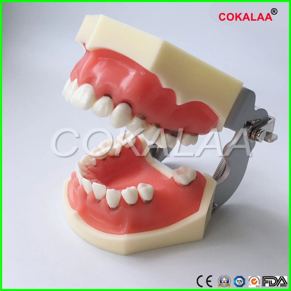 

Dental Periodontal Disease Model / Tooth Medical Model dentist learning model