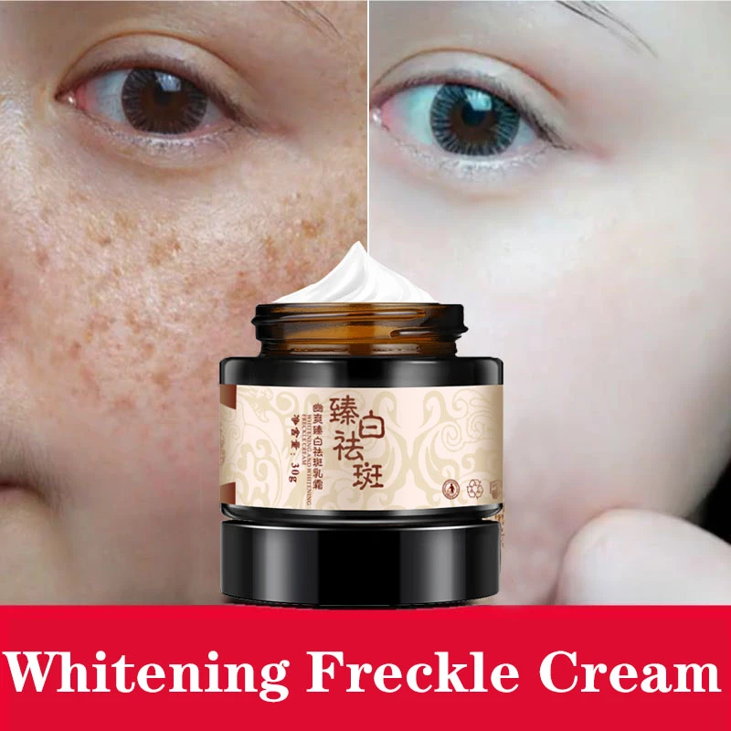 herbal cream for dark spots on face