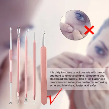 

5pcs Blackhead Remover Comedone Extractor Curved Tweezers Pimple Acne Blemish Removal Tools Set Double Ended Blackhead Remover