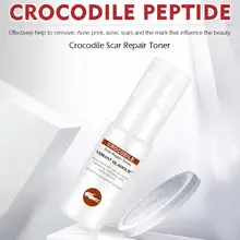 LANBENA уход за лицом Красота крокодиловый шрам ремонт вода акне Марка удаление гель мазь тела послеродовой унисекс уход за кожей