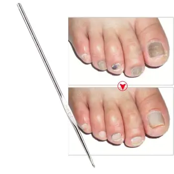 

Foot Care Tool Toe Nail Correction Nippers Clipper Dead Skin Dirt Remover