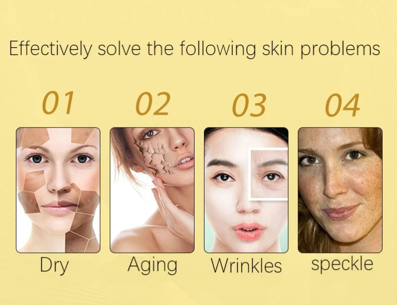 Димоллаурный коксовое кислотное Отбеливание Крем Fullerene 24k Золотая сыворотка melasma крем против акне пятна пигмент меланин крем для лица