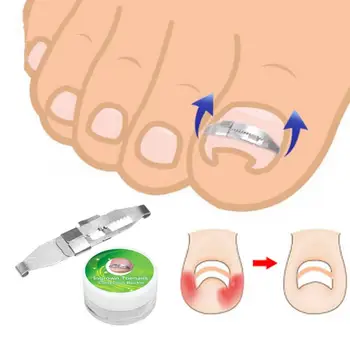 

Portable Stainless Steel Ingrown Toenail Corrector Pain Relief Paronychia Treatment Correcting Tool Therapy Nail Art Equipments