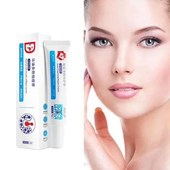 

2020 new 30g Acne Treatment Face Cream Blackhead Repair Gel