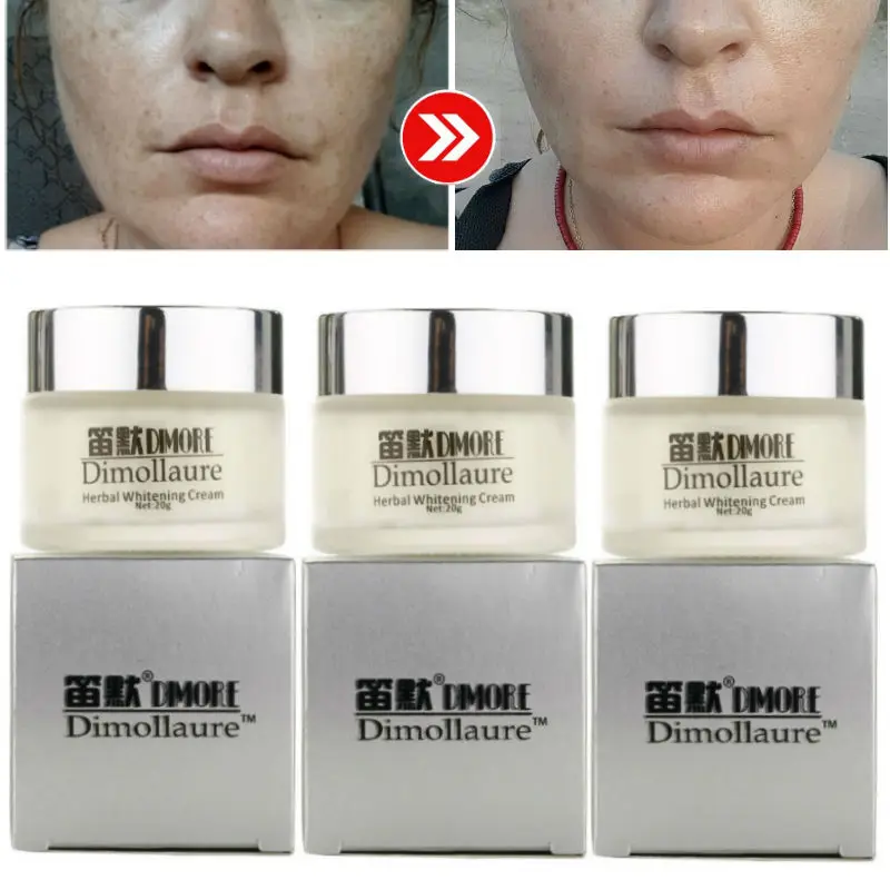 

3pcs Dimollaure Whitening Freckle Cream Moisturizing Removal Melasma Pigment Melanin Acne Scar Dark Spots Skin Care Brighten