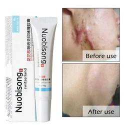 2pcs Nuobisong Removal Scar Cream Face Pimples Scar Stretch Marks Removal Acne Treatment Whitening Moisturizing Skin Body Cream