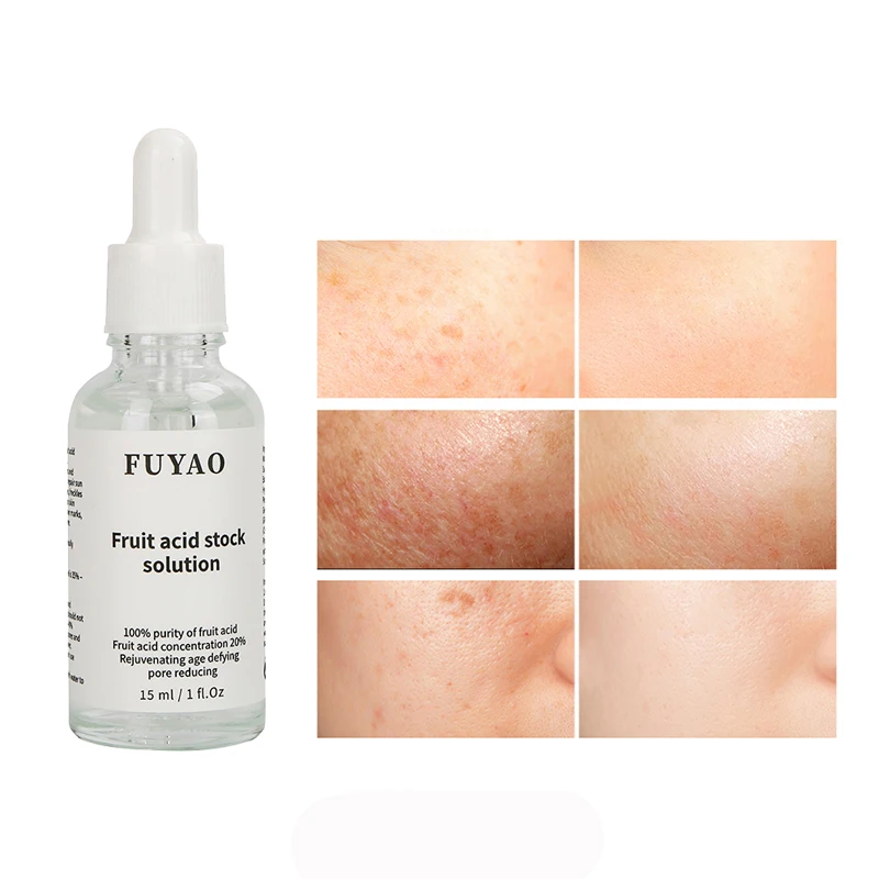 Facial Serum 20% Glycolic Acid Anti Wrinkles Whitening Skin Care