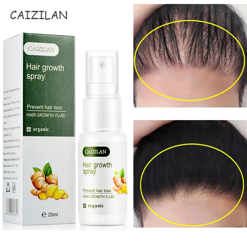 Hair Fast Growth Spray Ginger Essence Loss Treatment Prevent Dry Frizzy Damaged Repair Care Beauty Health Men Women | Красота и