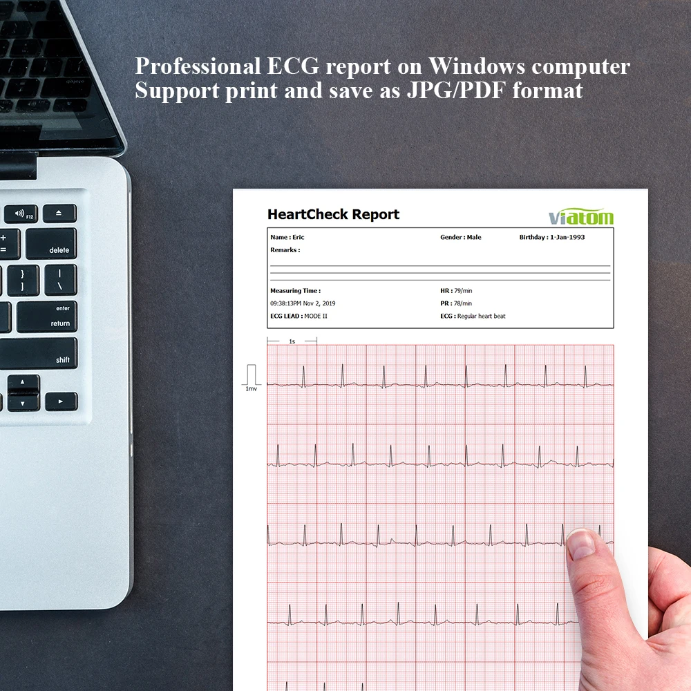  ECG/EKG Monitor Portable Heart Rate Monitor with PC Report Heart Health Fitness Tracker Viatom Hear