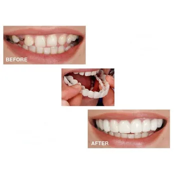 

Tooth Instant Perfect Smile Flex Teeth Whitening Smile False Teeth Cover