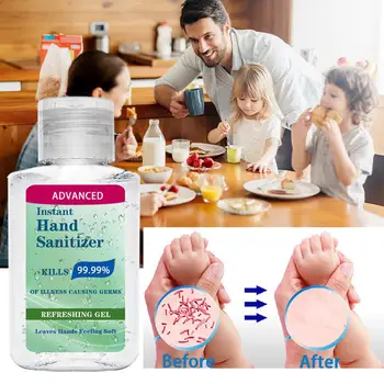 

Hand Antibacterial Press Head Amino Acid Hand Sanitizer Gel Effective Disinfection Hand Cleaner Disposable Rinse Free Gel