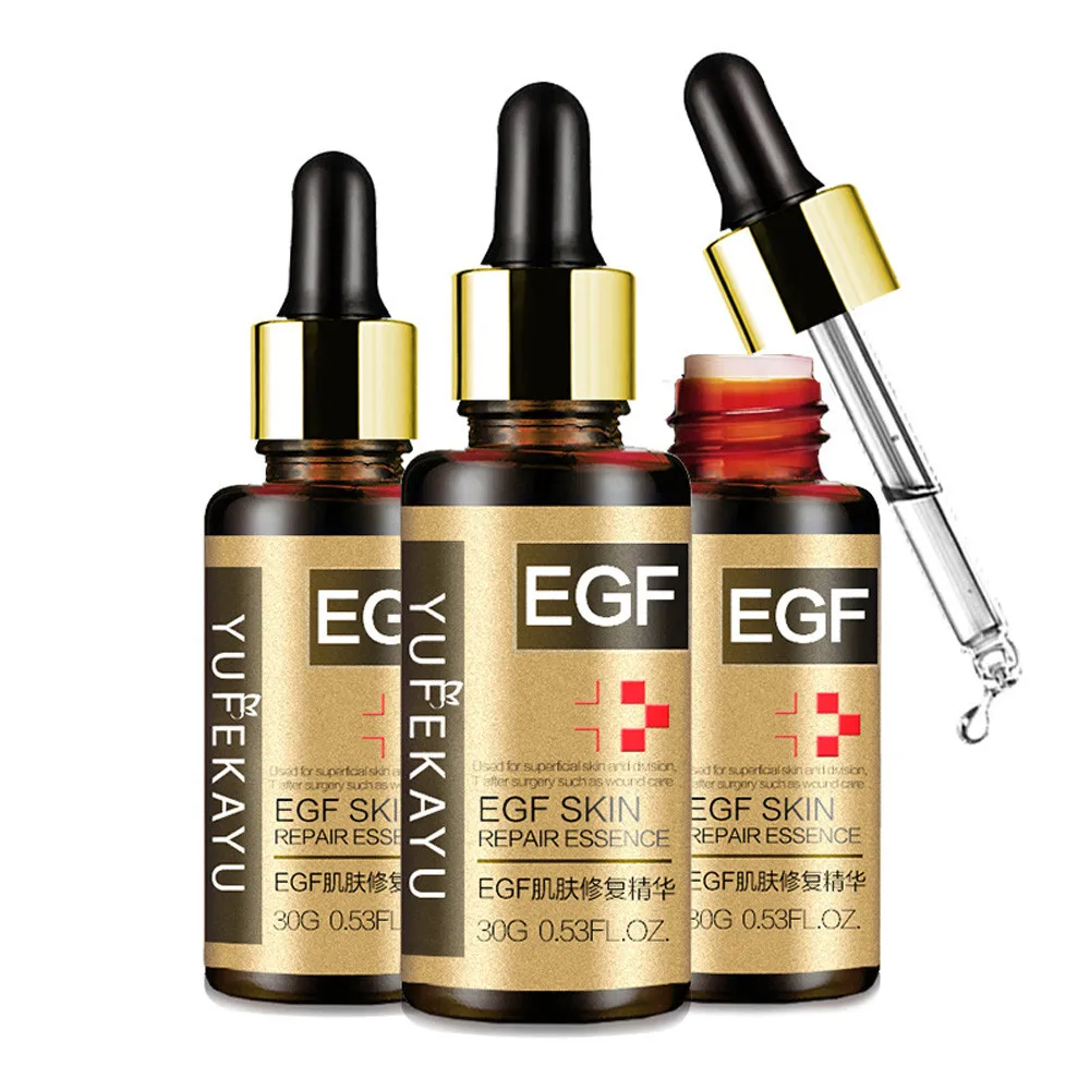 Для удаления рубцов от акне marks Essence Liquidtreatment Dark Spot уход за лицом; отбеливание эффективно удаляет ожоги рубцы хирургические рубцы