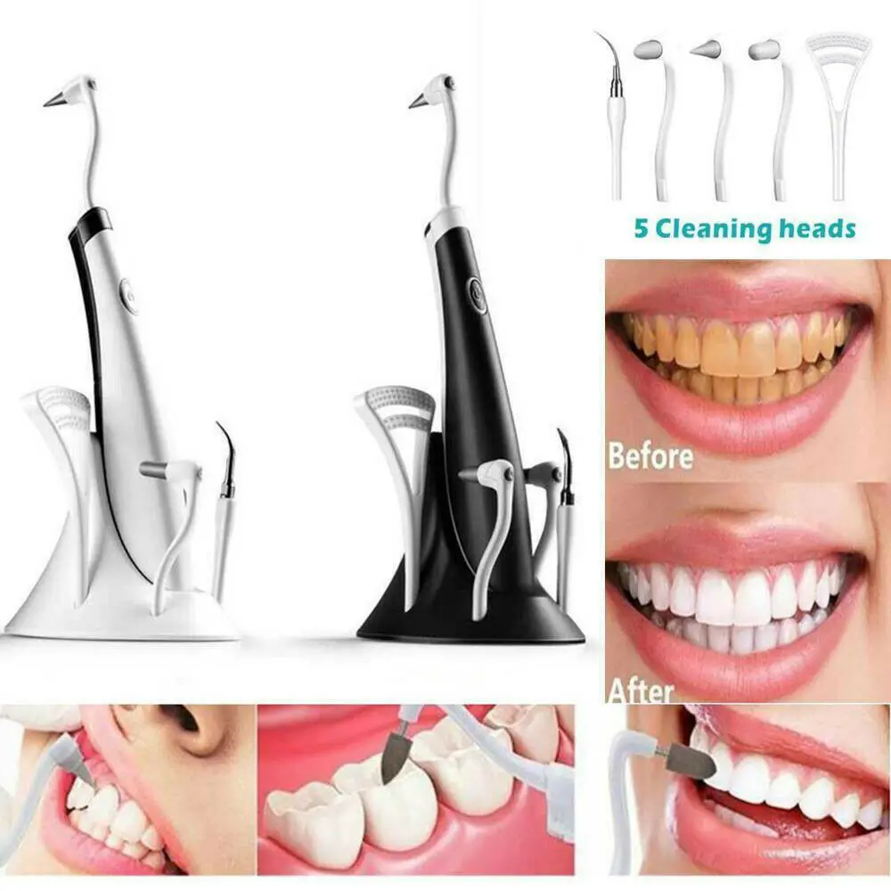

Electrical Sound Wave Dental Scaler Tooth High Frequency Vibration Stain Plaque Calculus Remover Teeth Whitening Cleaning Scaler