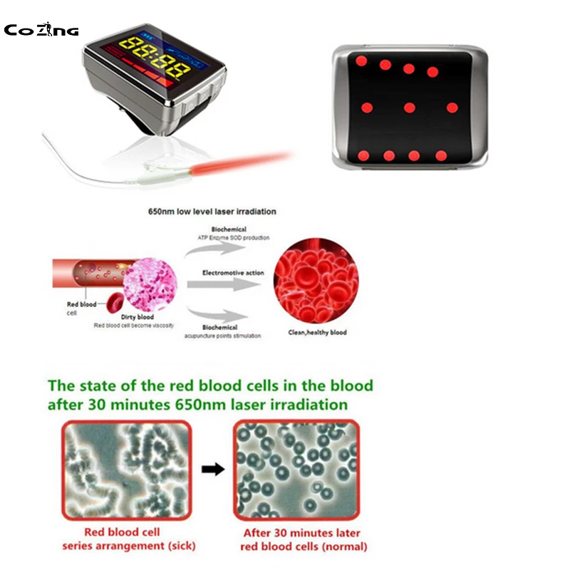 

Home Remedies Diabetes Treatment Equipment Physical Therapy Wrist Watch Treatment Blood Pressure Stroke Rhinitus