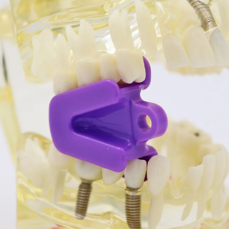 5 шт. стоматологический резиновый окклюзионный коврик для рта опора для укуса орального окклюзирования для открывания рта Ретрактор Стоматологический материал стоматологический лабораторный инструмент