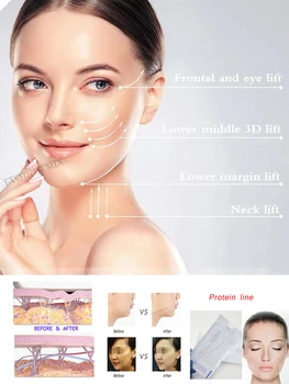 

Silk Fibroin Line Collagen Facial Thread Lift Anti Aging Carving Essence Hyaluronic Tightening Skin Care Radar Thread No Needle