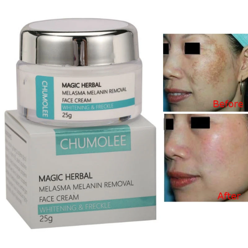 sun spots cream