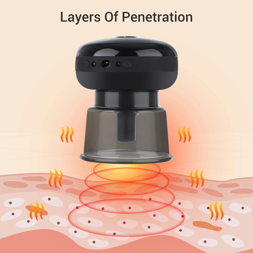 Elektriskais Cupping Gua Sha Scraping Vakuuma sūkšanas Masieris ar Red Light mugurkaula vidukļa terapiju Muguras ķermeņa pretcelulīta instrumenti_voghion.com