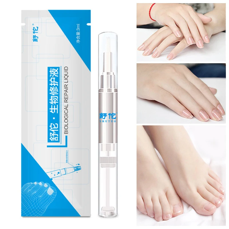 3ml Nail Fungus Treatment Liquid Anti Fungal Finger Toe Nails Care NShopping