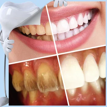 

Newly 2+10strips Nano Teeth Whitening Kit Tooth Cleaning Whitener Brush Tooth Stains CTN88