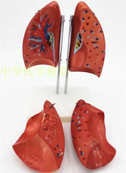 

Human lung anatomical model lung leaf model respiratory system lung model lung leaflet