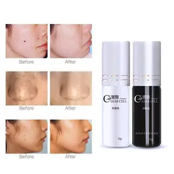 

Chinese Medication Speckle Freckle Moles Remove Water Removal Drops Speckle Tags Skin Seamless Cream Water Freckle G7U1