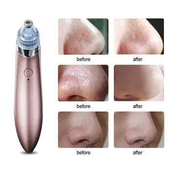 

Pore Cleaner Deep Cleansing Dead Skin Blackhead Remover Face Massager Skin Care waterproof beauty tools Suitable all skin types