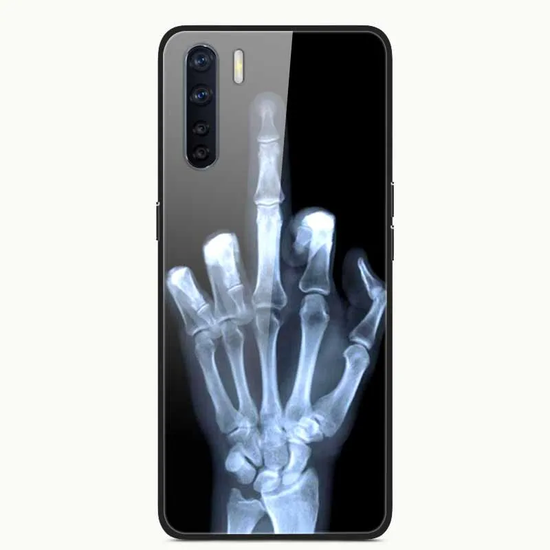 Premium Tempered Glass Hard Back Case - Elegant Protection