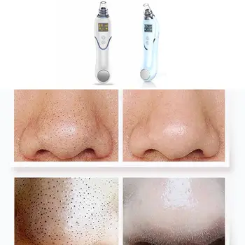 

Electric Blackhead Removing Instrument Artifact Household Cold And Hot Cleansing And Skin Rejuvenation Beauty Instrument