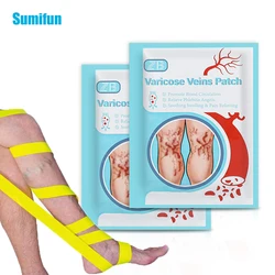 12Pcs Varicose Veins Treatment Patches Vasculitis Phlebitis Spider Sticker Varicosity Angiitis Medical Plaster